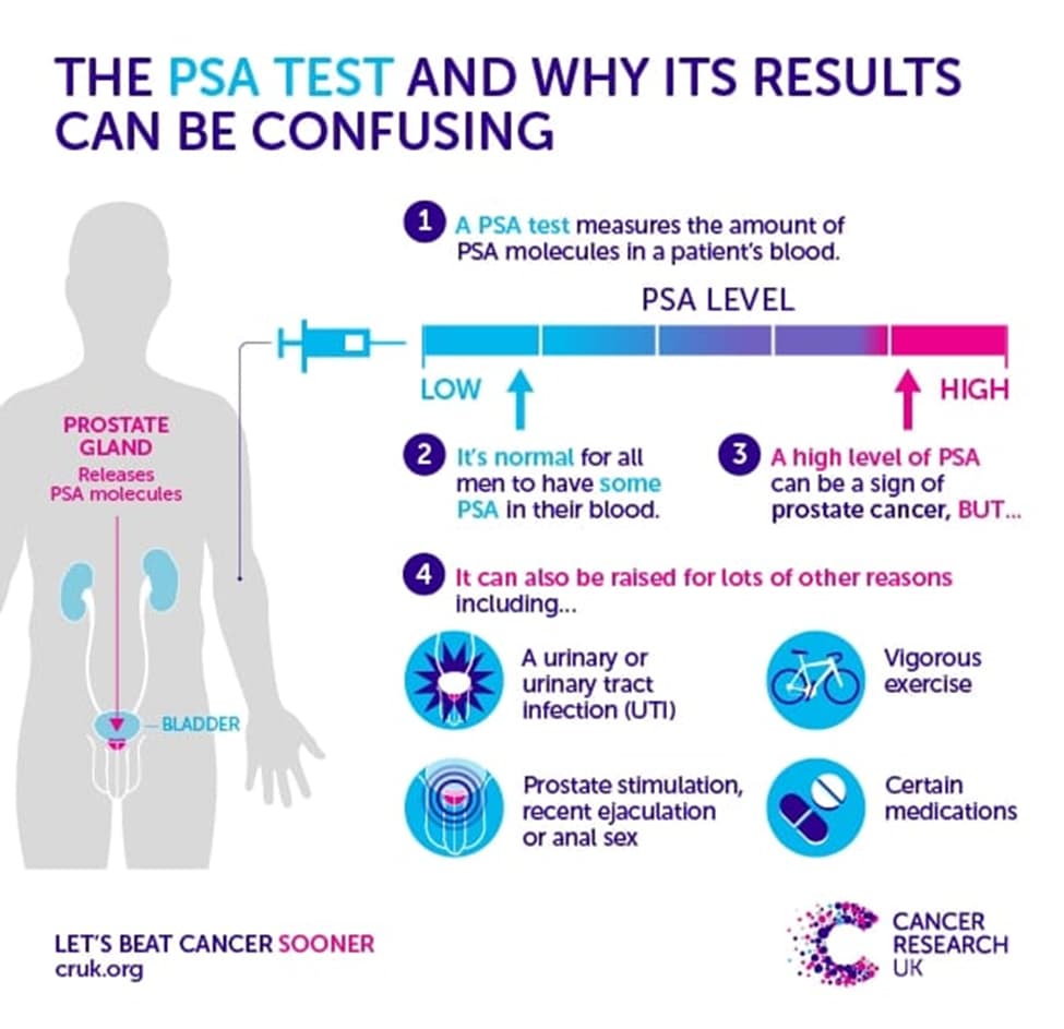 Pros y contras del cribado del cáncer de próstata