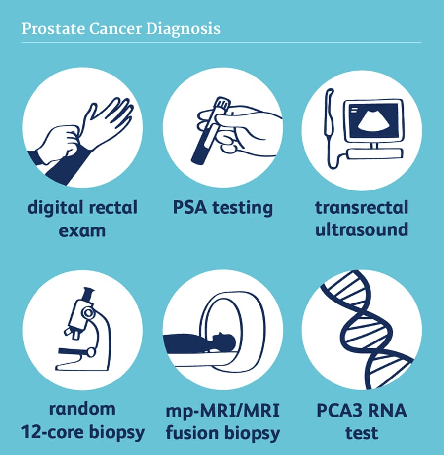 Pruebas utilizadas para el cribado del cáncer de próstata